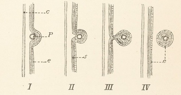 Schematische Darstellung Perlsack Entstehung Grafik Louis Boutan 1925